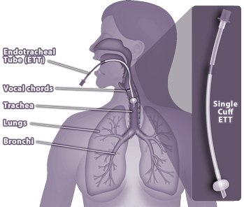 Medical illustration showing lungs and respiratory system